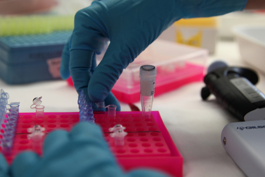 El CIBIR identifica nuevos biomarcadores para el diagnóstico precoz del cáncer de páncreas
